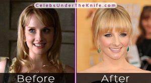 melissa tits|Melissa Rauch Breast Implants and Reductions